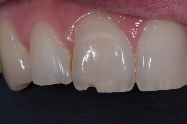 Eric+s+before