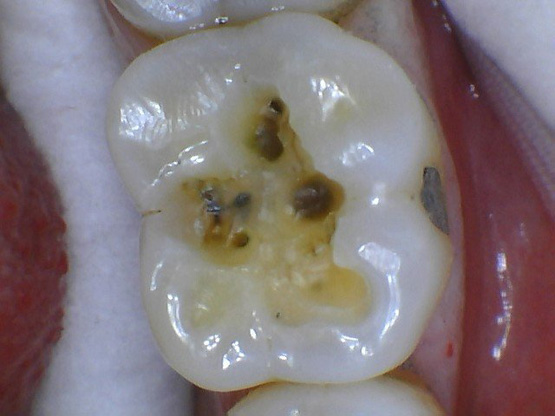 Gina+l+before