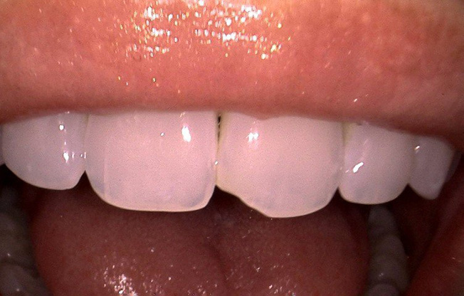 Jan+p+before