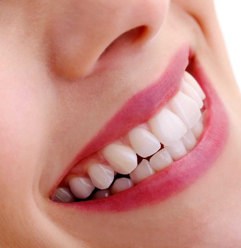 Close up of a woman’s brilliant smile