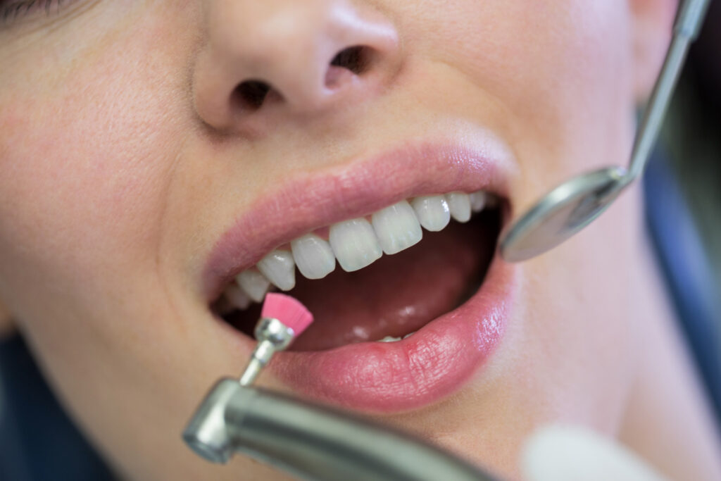 Close up the mouth of a patient about to be a cleaned with a small dental brush and mirror